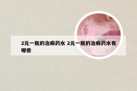 2元一瓶的治癣药水 2元一瓶的治癣药水有哪些