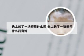 头上长了一块癣用什么药 头上长了一块癣用什么药膏好