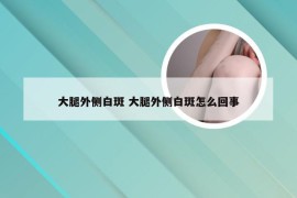 大腿外侧白斑 大腿外侧白斑怎么回事