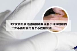 3岁女孩后脑勺起癣摸着里面有小球球啥原因 三岁小孩后脑勺有个小疙瘩会动