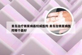 青岛治疗银屑病最权威医院 青岛治银屑病医院哪个最好
