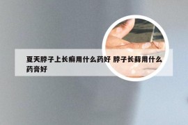 夏天脖子上长癣用什么药好 脖子长藓用什么药膏好