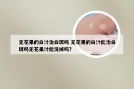 无花果的白汁治白斑吗 无花果的白汁能治白斑吗无花果汁能洗掉吗?