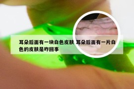 耳朵后面有一块白色皮肤 耳朵后面有一片白色的皮肤是咋回事