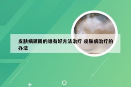 皮肤病顽固的谁有好方法治疗 皮肤病治疗的办法