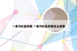 一条沟红色的癣 一条沟红色的癣怎么回事