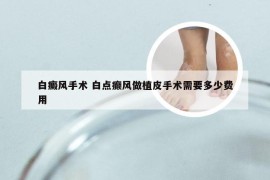 白癜风手术 白点癫风做植皮手术需要多少费用