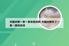 大腿内侧一条一条白色的线 大腿内侧长了一条一条的白纹