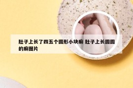 肚子上长了四五个圆形小块癣 肚子上长圆圆的癣图片