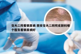 交大二院看银屑病 西安交大二附院皮肤科哪个医生看银屑病好