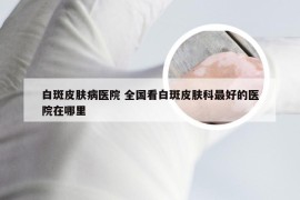 白斑皮肤病医院 全国看白斑皮肤科最好的医院在哪里