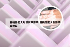 扁桃体肥大对银屑病影响 扁桃体肥大会影响容貌吗