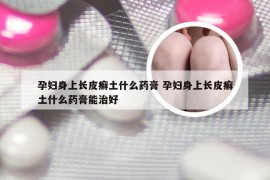 孕妇身上长皮癣土什么药膏 孕妇身上长皮癣土什么药膏能治好