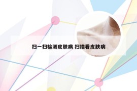 扫一扫检测皮肤病 扫描看皮肤病
