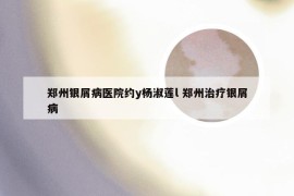郑州银屑病医院约y杨淑莲l 郑州治疗银屑病