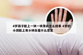 4岁孩子脸上一块一块发白怎么回事 4岁的小孩脸上有小块白是什么意思