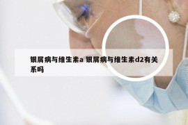 银屑病与维生素a 银屑病与维生素d2有关系吗