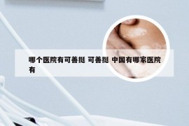 哪个医院有可善挺 可善挺 中国有哪家医院有