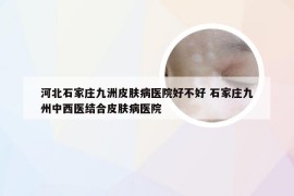 河北石家庄九洲皮肤病医院好不好 石家庄九州中西医结合皮肤病医院