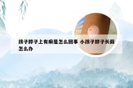 孩子脖子上有癣是怎么回事 小孩子脖子长藓怎么办