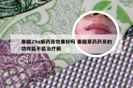 泰国29α癣药膏效果好吗 泰国草药药膏的功效能不能治疗癣