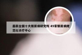 最新全国十大银屑病研究所 49家银屑病规范化诊疗中心