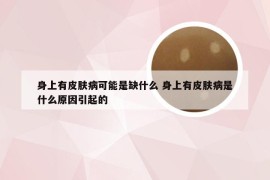 身上有皮肤病可能是缺什么 身上有皮肤病是什么原因引起的