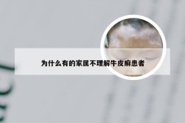 为什么有的家属不理解牛皮癣患者
