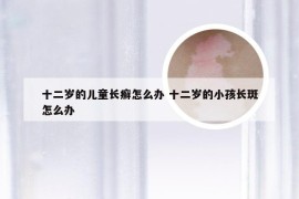 十二岁的儿童长癣怎么办 十二岁的小孩长斑怎么办