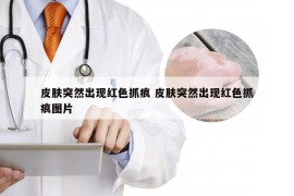 皮肤突然出现红色抓痕 皮肤突然出现红色抓痕图片
