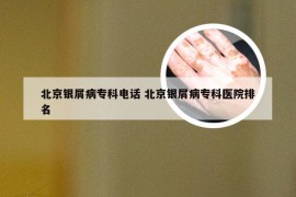 北京银屑病专科电话 北京银屑病专科医院排名