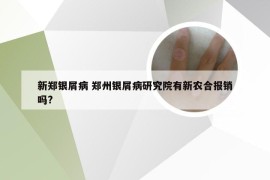 新郑银屑病 郑州银屑病研究院有新农合报销吗?
