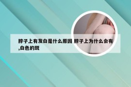 脖子上有发白是什么原因 脖子上为什么会有,白色的斑