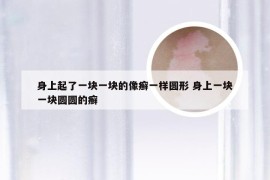 身上起了一块一块的像癣一样圆形 身上一块一块圆圆的癣