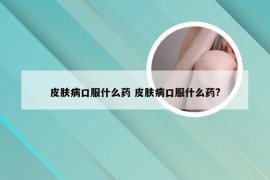 皮肤病口服什么药 皮肤病口服什么药?