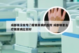 成都有没有专门看银屑病的医院 成都哪里治疗银屑病比较好