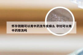 怀孕初期可以用中药洗牛皮癣么 孕妇可以用中药擦洗吗
