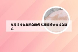 肛周湿疹会出现白斑吗 肛周湿疹会变成白斑吗