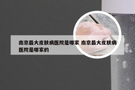 南京最大皮肤病医院是哪家 南京最大皮肤病医院是哪家的