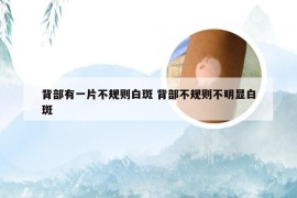 背部有一片不规则白斑 背部不规则不明显白斑