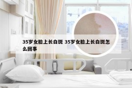 35岁女脸上长白斑 35岁女脸上长白斑怎么回事