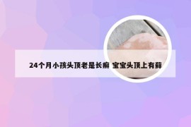 24个月小孩头顶老是长癣 宝宝头顶上有藓