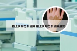 脸上长癣怎么消除 脸上长癣怎么消除最快