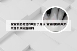 宝宝的脸出现白斑什么原因 宝宝的脸出现白斑什么原因造成的