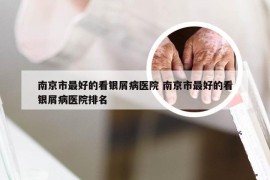 南京市最好的看银屑病医院 南京市最好的看银屑病医院排名