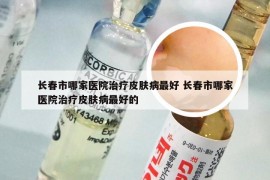 长春市哪家医院治疗皮肤病最好 长春市哪家医院治疗皮肤病最好的