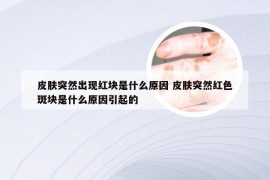 皮肤突然出现红块是什么原因 皮肤突然红色斑块是什么原因引起的
