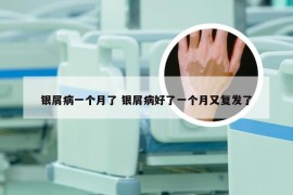 银屑病一个月了 银屑病好了一个月又复发了