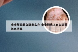 宝宝额头起白斑怎么办 宝宝额头上有白斑是怎么回事
