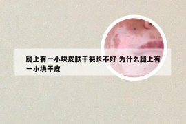 腿上有一小块皮肤干裂长不好 为什么腿上有一小块干皮